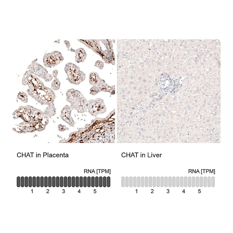 Atlas Antibodies Anti-CHAT Antibody