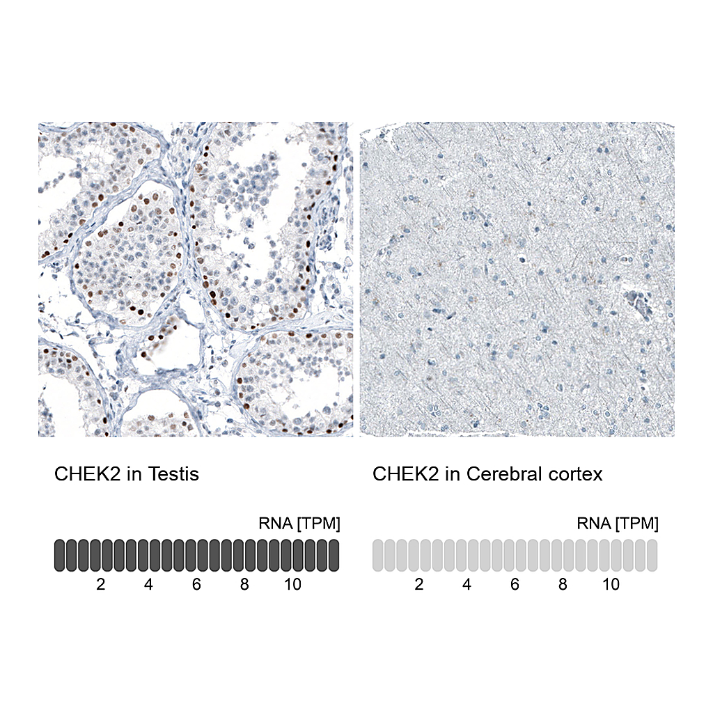 Atlas Antibodies Anti-CHEK2 Antibody