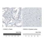 Atlas Antibodies Anti-CHEK2 Antibody