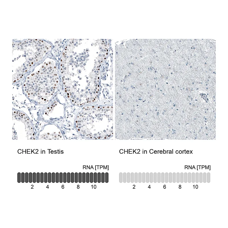 Atlas Antibodies Anti-CHEK2 Antibody