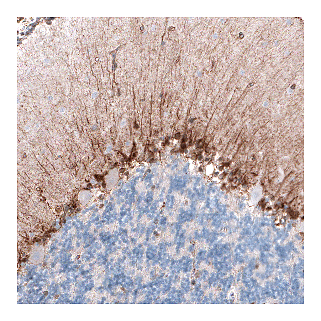 Atlas Antibodies Anti-CLIP1 Antibody