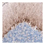 Atlas Antibodies Anti-CLIP1 Antibody
