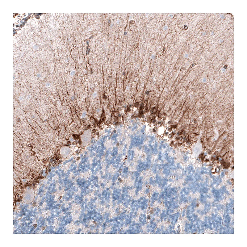 Atlas Antibodies Anti-CLIP1 Antibody