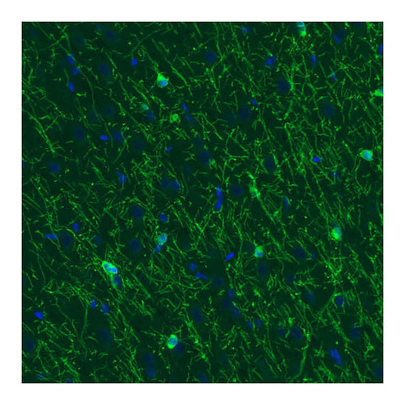 Atlas Antibodies Anti-CNP Antibody