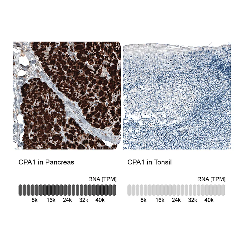 Atlas Antibodies Anti-CPA1 Antibody