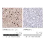 Atlas Antibodies Anti-CRYAB Antibody