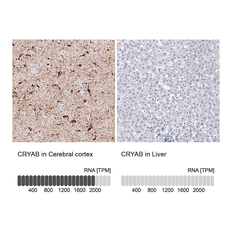 Atlas Antibodies Anti-CRYAB Antibody