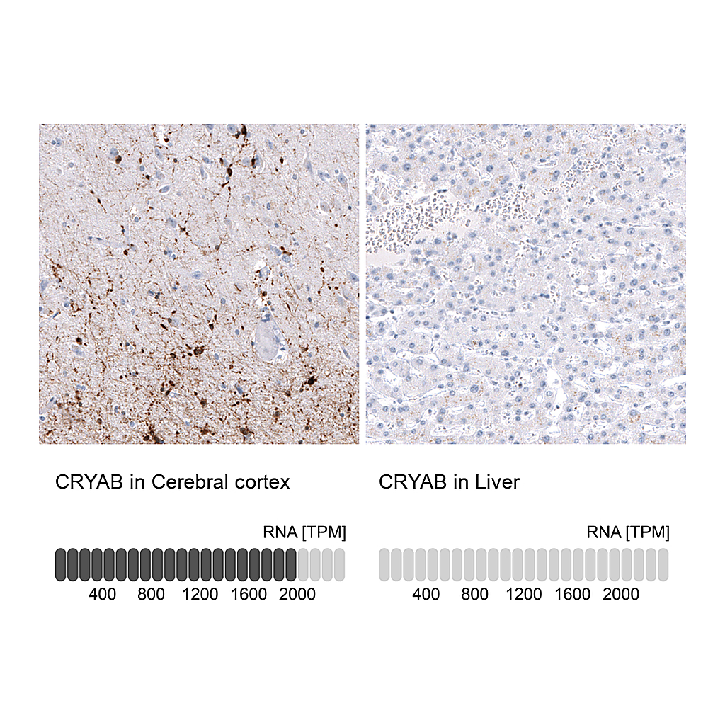Atlas Antibodies Anti-CRYAB Antibody