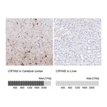 Atlas Antibodies Anti-CRYAB Antibody