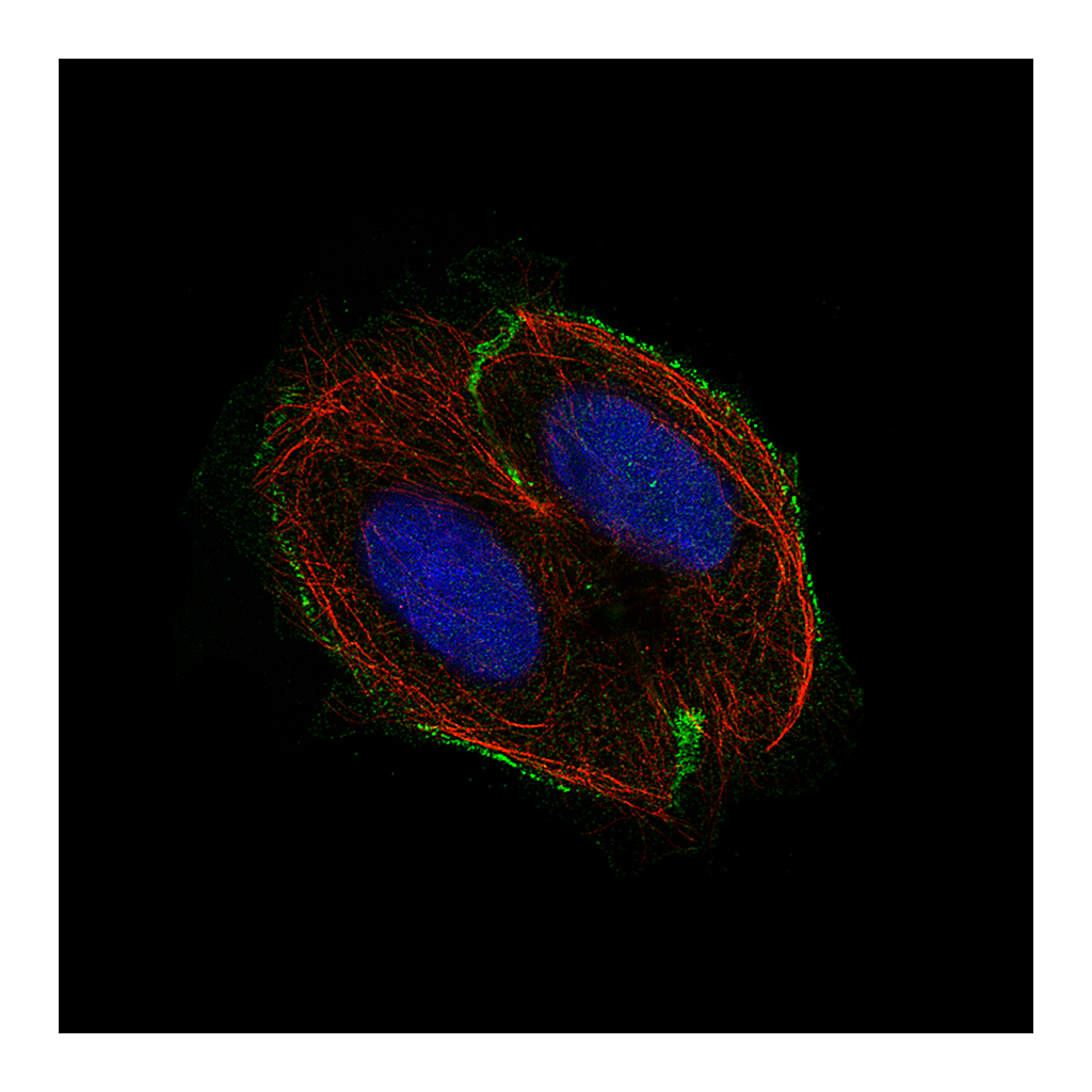 Atlas Antibodies Anti-CSF1R Antibody