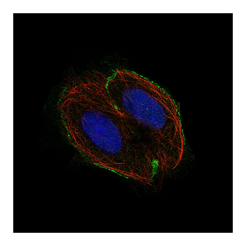 Atlas Antibodies Anti-CSF1R Antibody