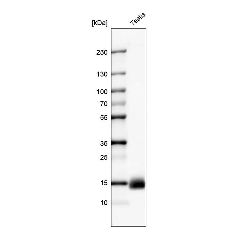Atlas Antibodies Anti-CTAG1B Antibody