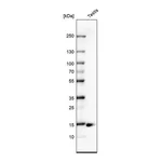 Atlas Antibodies Anti-CTAG1B Antibody