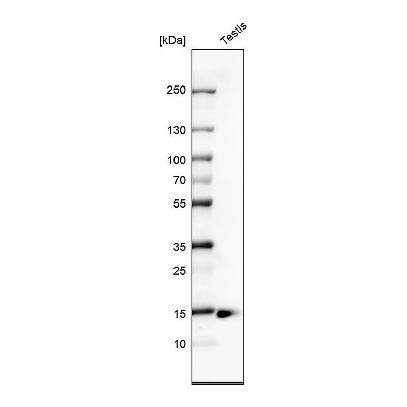 Atlas Antibodies Anti-CTAG1B Antibody
