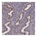 Atlas Antibodies Anti-CTCF Antibody