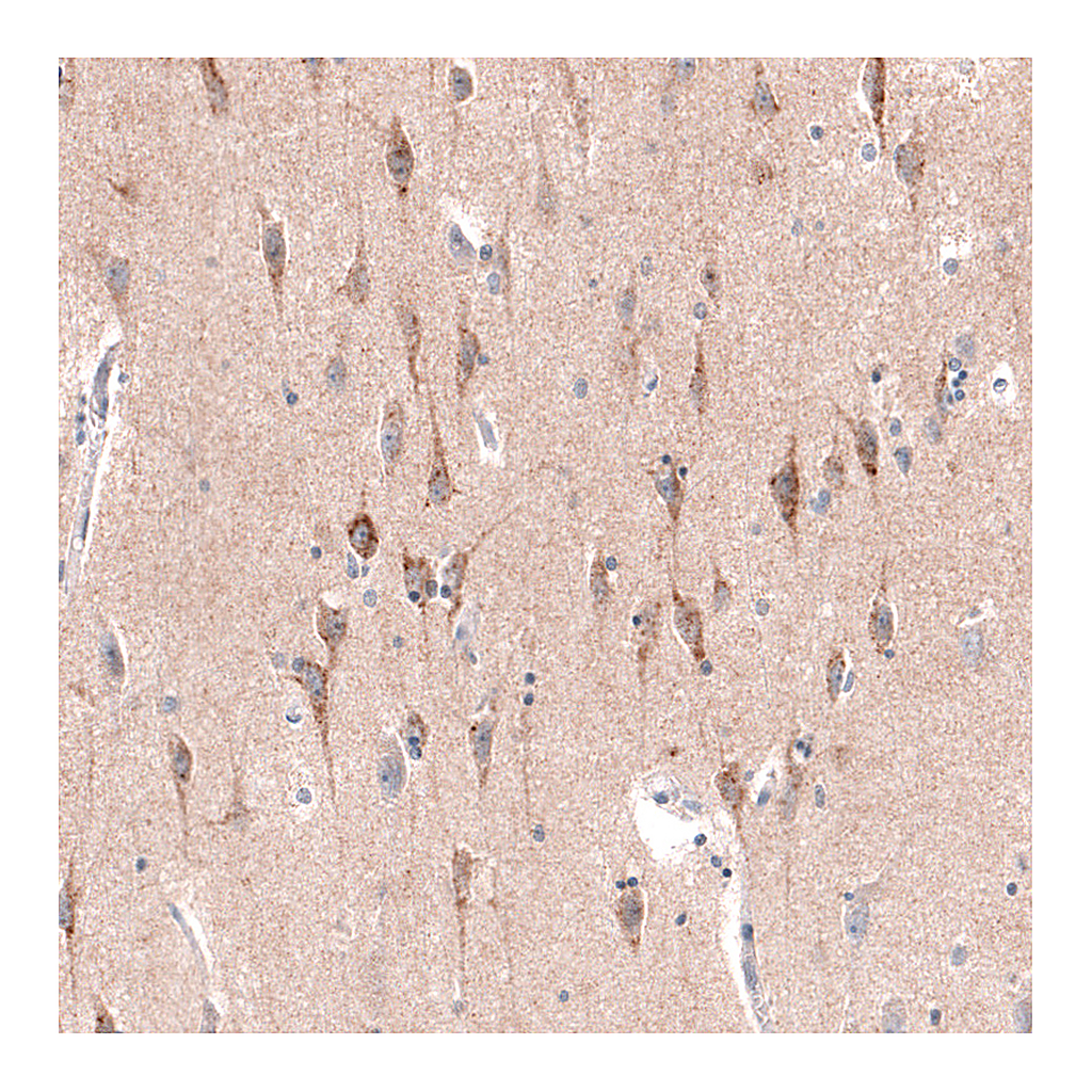 Atlas Antibodies Anti-CTGF Antibody