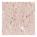 Atlas Antibodies Anti-CTGF Antibody