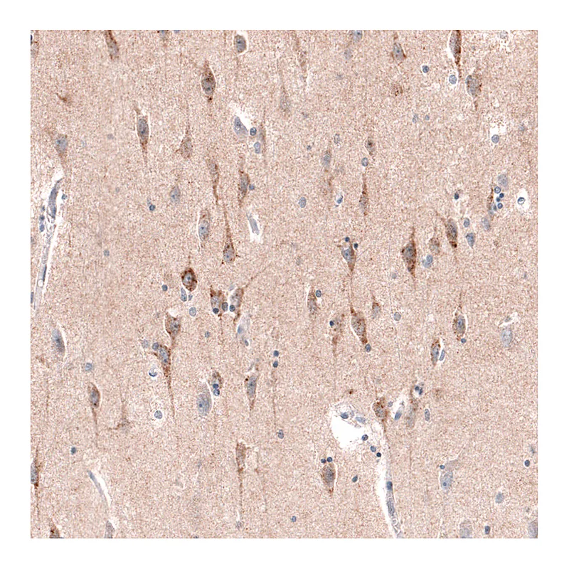 Atlas Antibodies Anti-CTGF Antibody