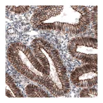 Atlas Antibodies Anti-CTNNB1 Antibody