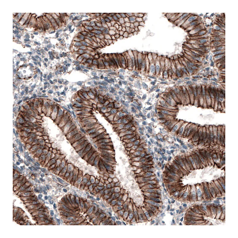 Atlas Antibodies Anti-CTNNB1 Antibody