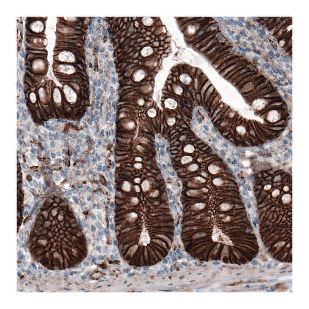 Atlas Antibodies Anti-CTNNB1 Antibody