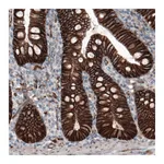 Atlas Antibodies Anti-CTNNB1 Antibody