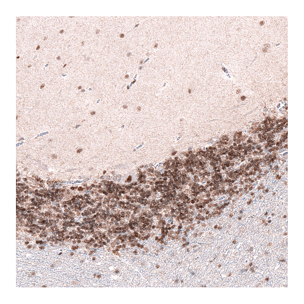 Atlas Antibodies Anti-CUX1 Antibody