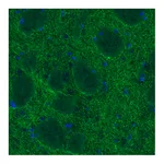 Atlas Antibodies Anti-DAT Antibody
