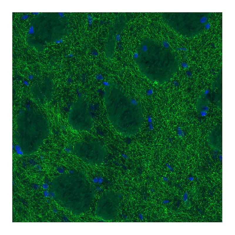 Atlas Antibodies Anti-DAT Antibody