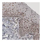 Atlas Antibodies Anti-DAXX Antibody