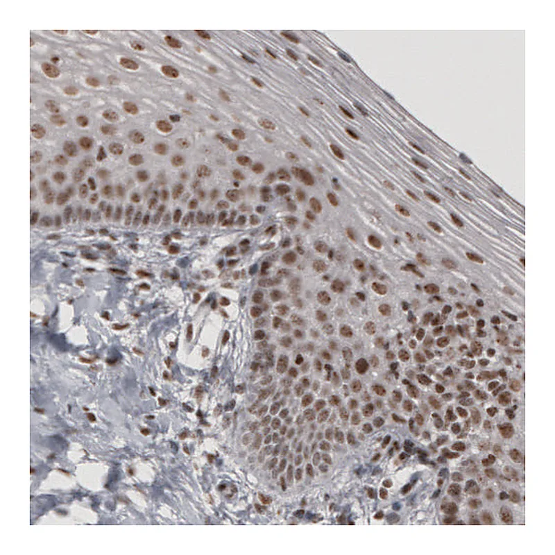 Atlas Antibodies Anti-DAXX Antibody