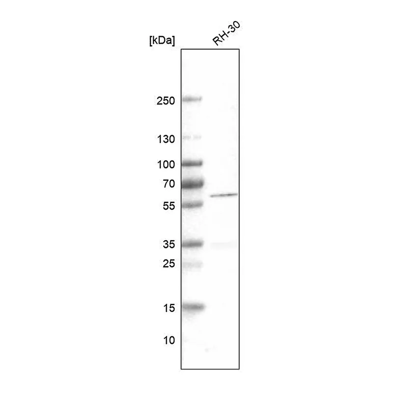 Atlas Antibodies Anti-DES Antibody
