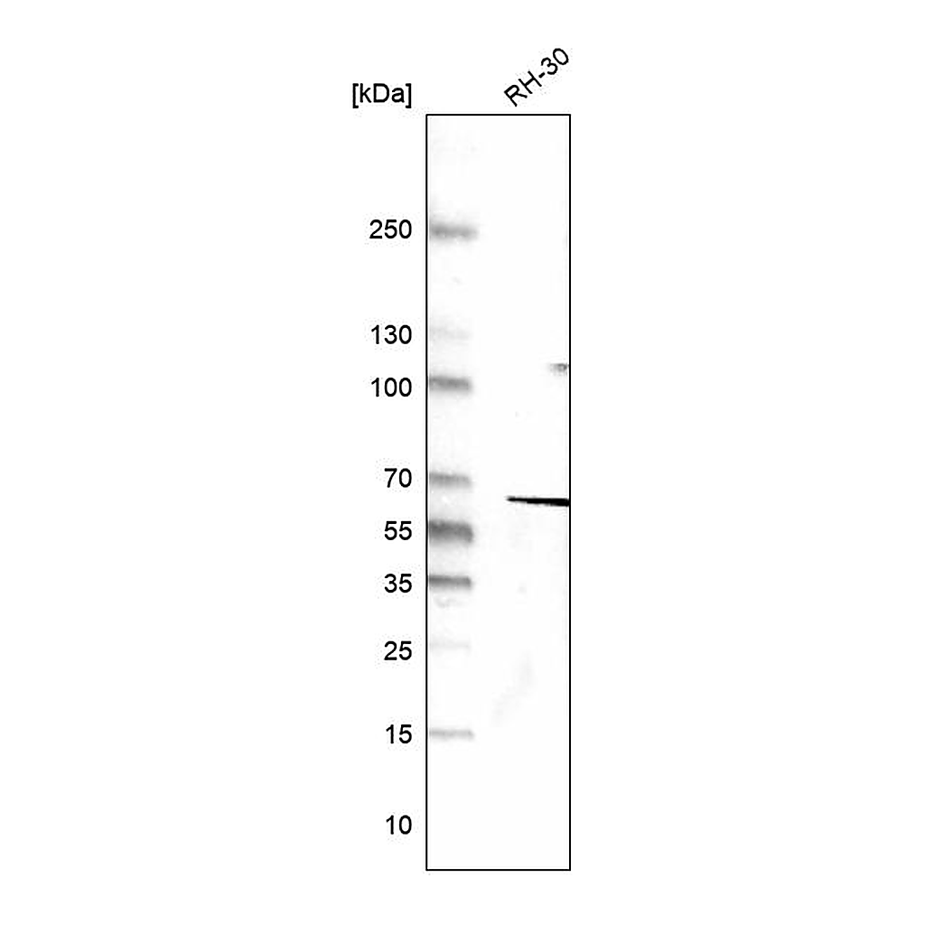 Atlas Antibodies Anti-DES Antibody