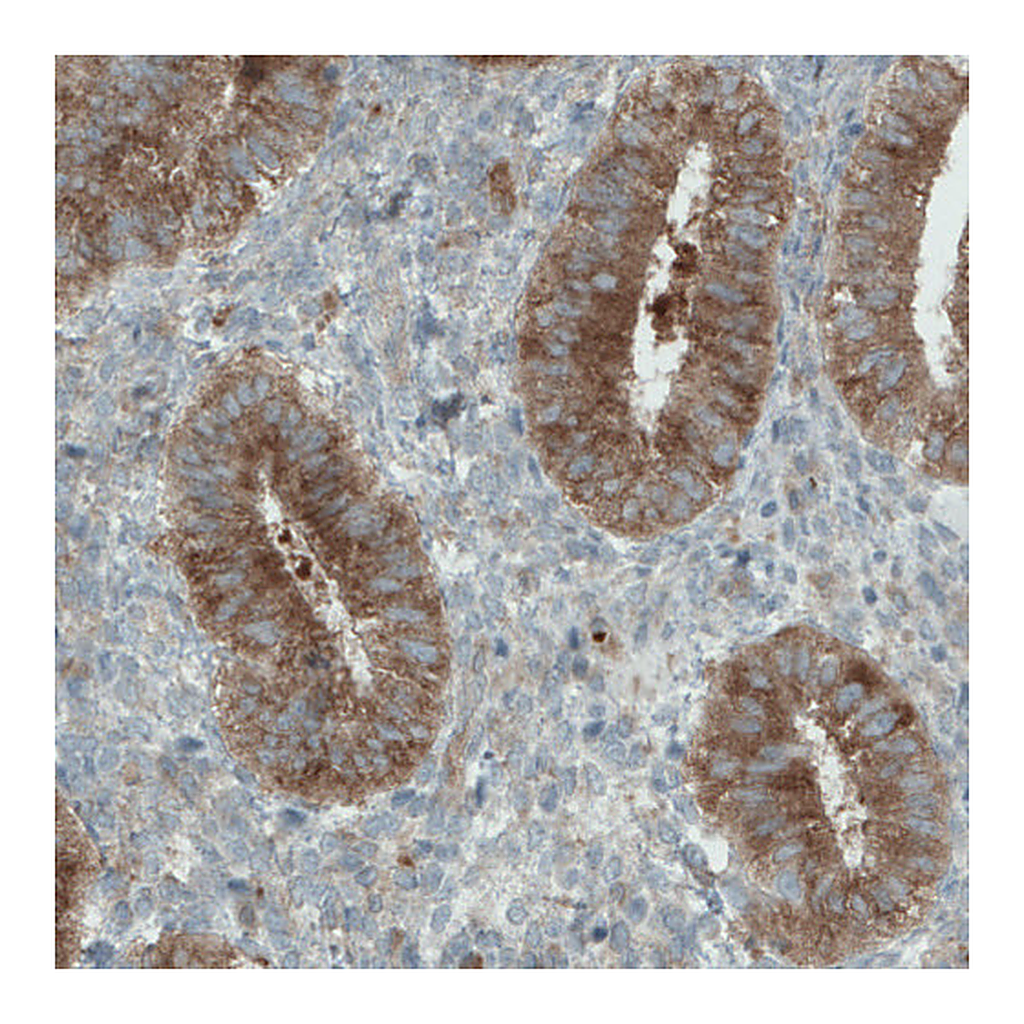 Atlas Antibodies Anti-DIAPH2 Antibody