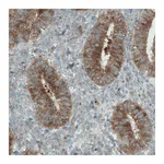 Atlas Antibodies Anti-DIAPH2 Antibody
