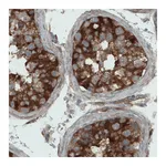 Atlas Antibodies Anti-DIAPH2 Antibody