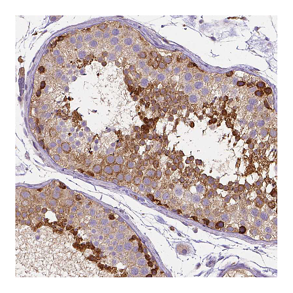 Atlas Antibodies Anti-DICER1 Antibody