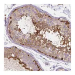 Atlas Antibodies Anti-DICER1 Antibody