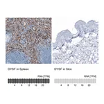 Atlas Antibodies Anti-DYSF Antibody