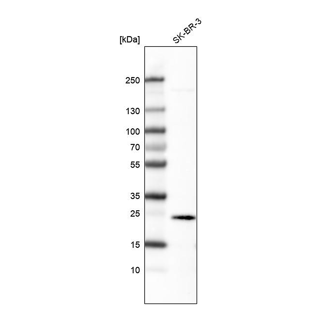 Atlas Antibodies Anti-EFNA1 Antibody