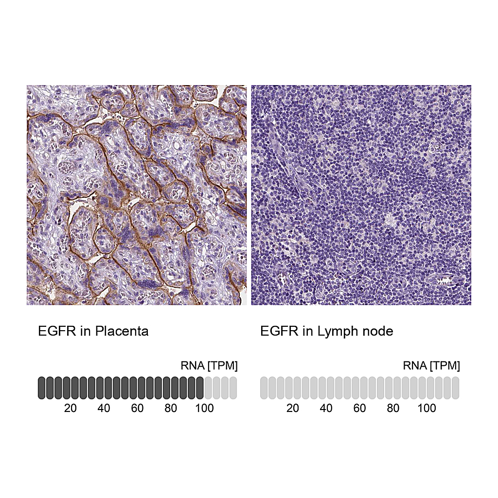 Atlas Antibodies Anti-EGFR Antibody