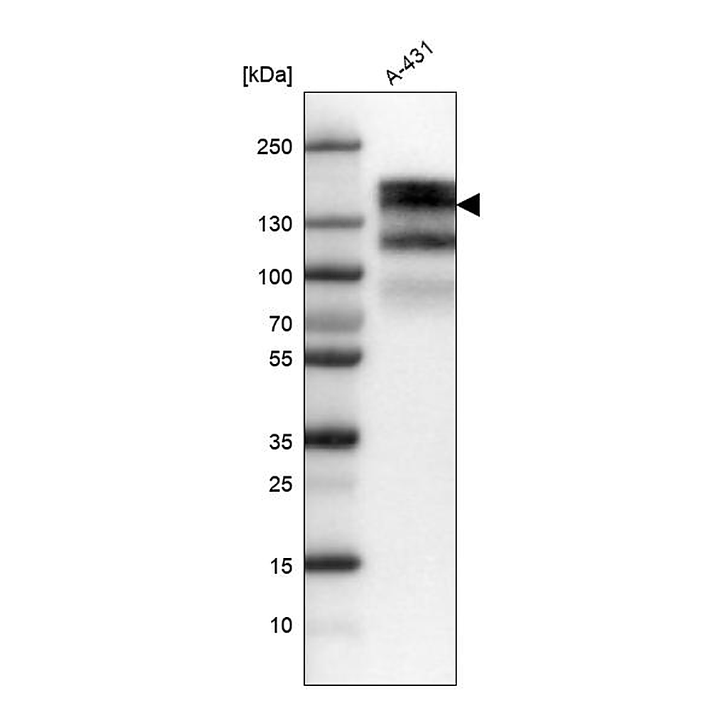 Atlas Antibodies Anti-EGFR Antibody