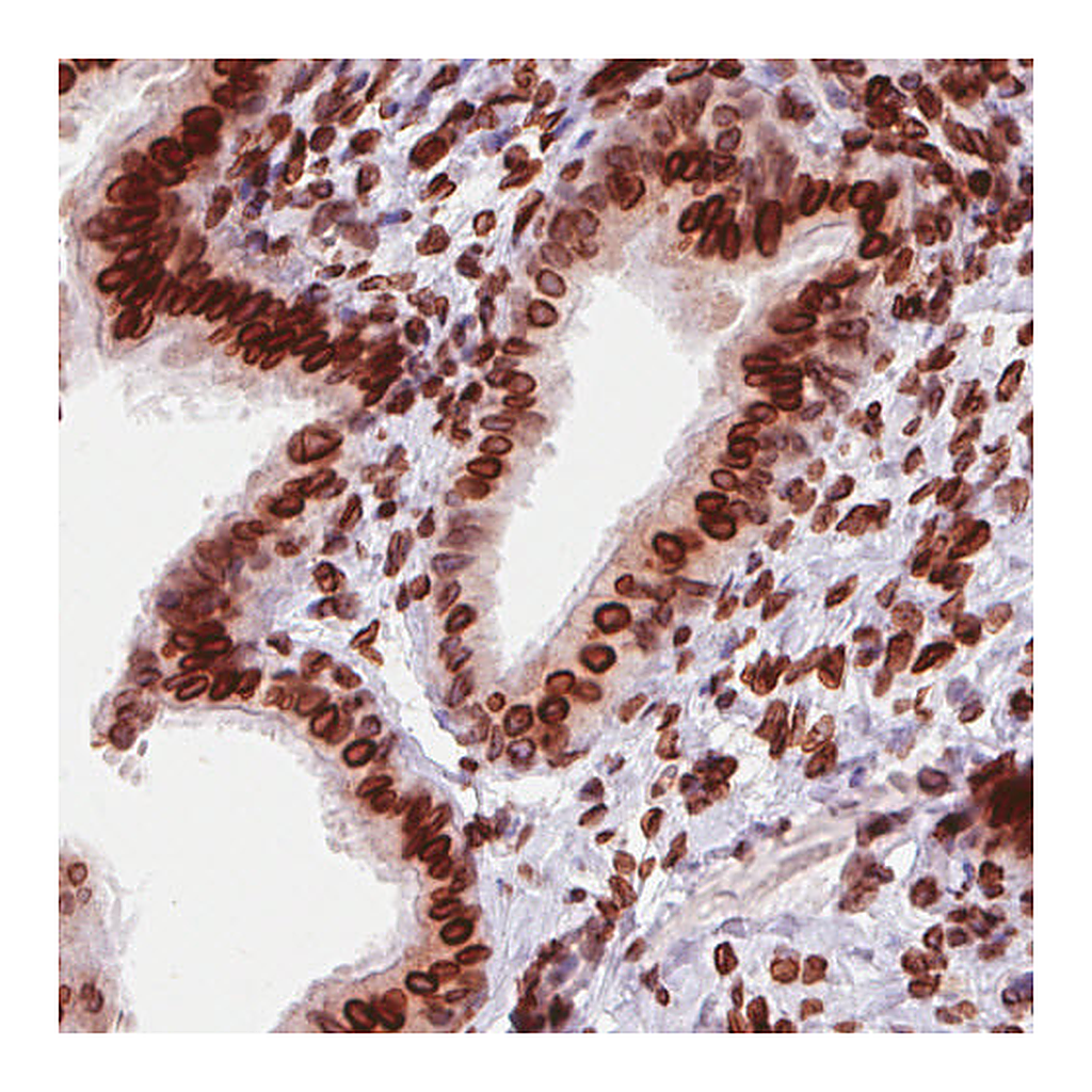 Atlas Antibodies Anti-EMD Antibody