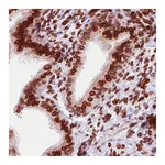 Atlas Antibodies Anti-EMD Antibody