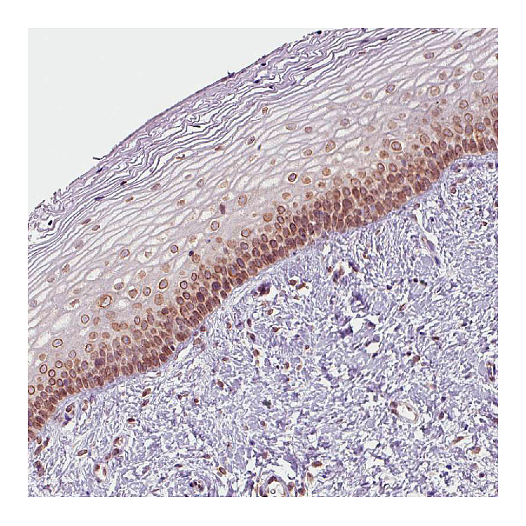 Atlas Antibodies Anti-EMD Antibody