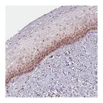 Atlas Antibodies Anti-EMD Antibody