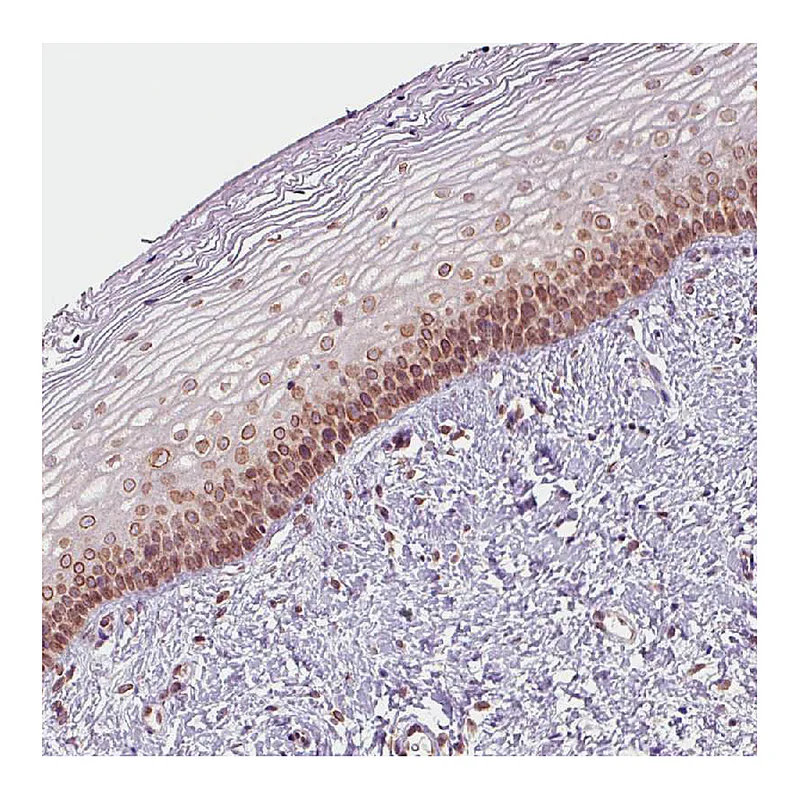Atlas Antibodies Anti-EMD Antibody