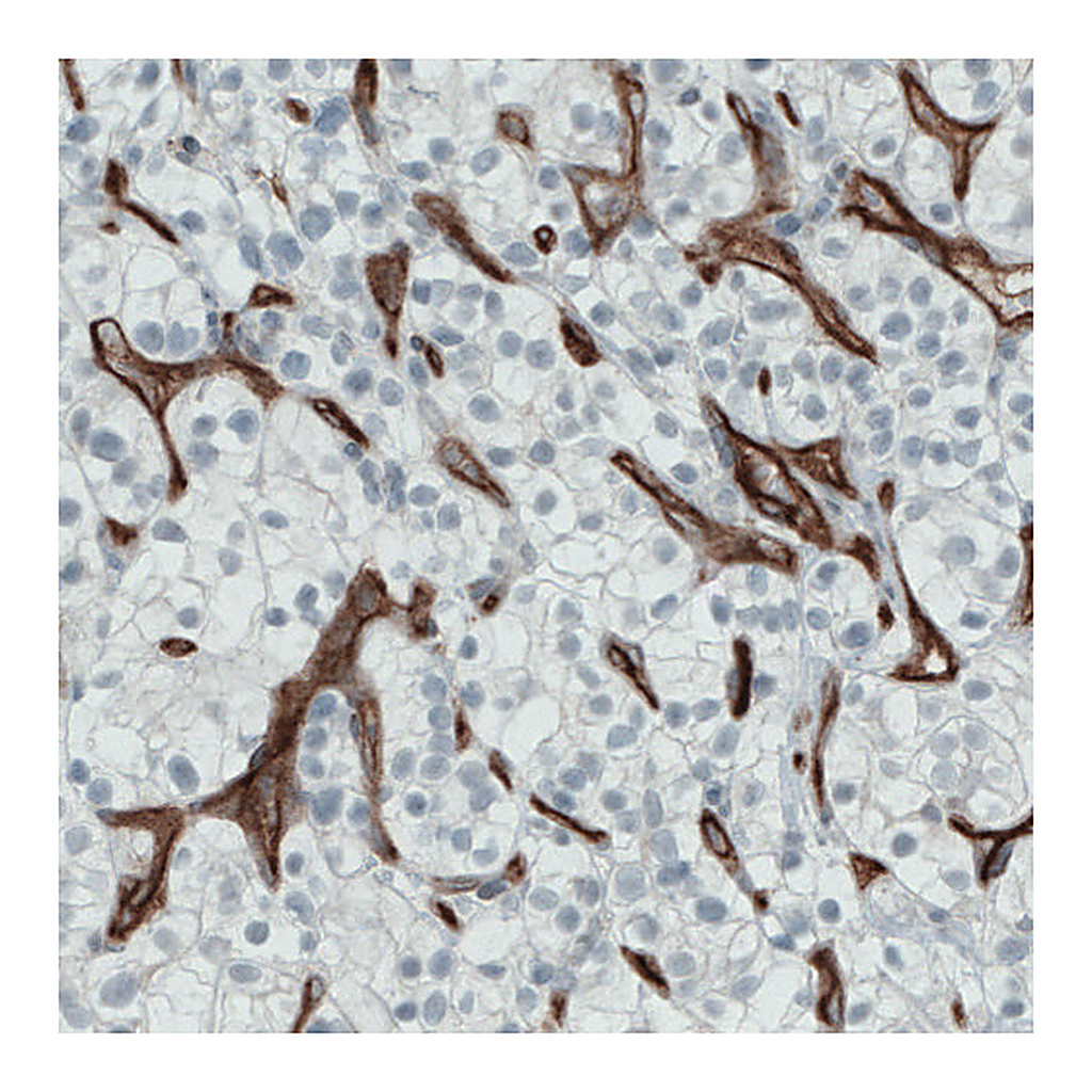 Atlas Antibodies Anti-ENG Antibody