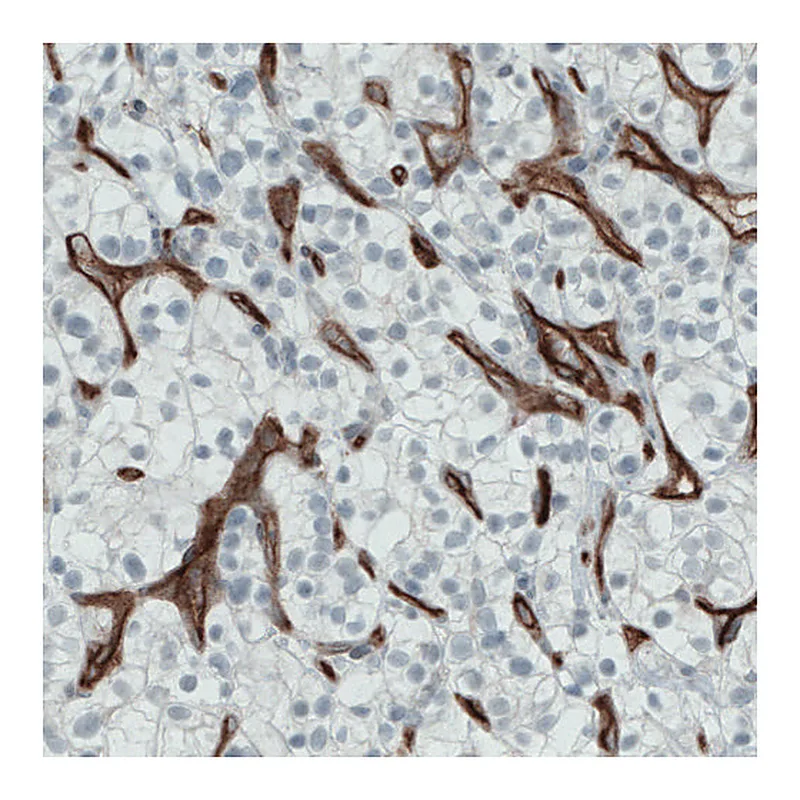 Atlas Antibodies Anti-ENG Antibody