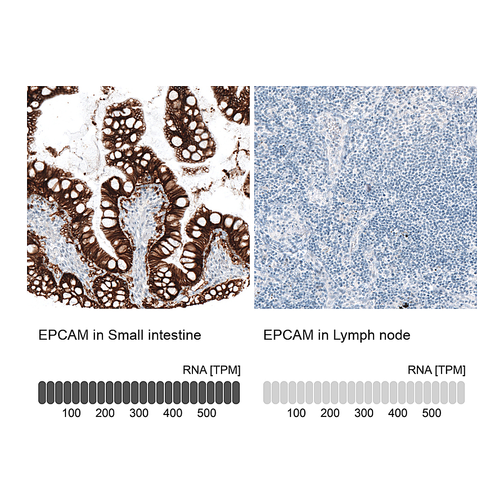 Atlas Antibodies Anti-EPCAM Antibody